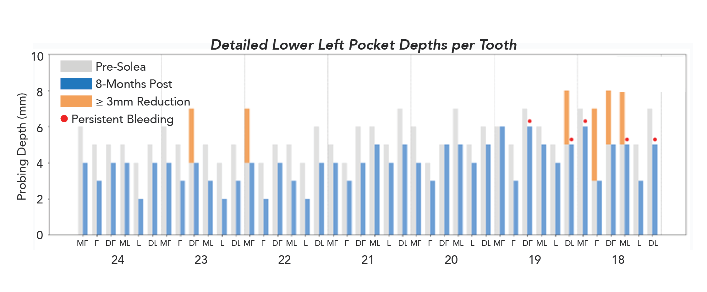 Periodontitis Patient Detailed Lower Left Pocket Depths per Tooth Pre- and 8-Months Post Solea Perioguide Treatment