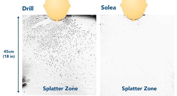 Dental Splatter Zone of Solea and Drill