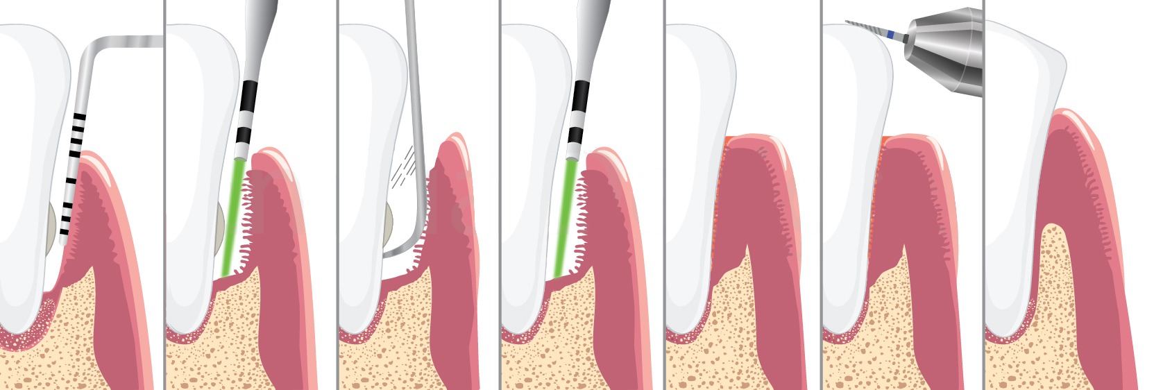Solea Perioguide Illustration