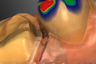 Photoshop for Tissue_Dr. Anderson
